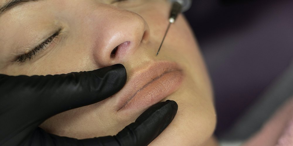 injecting lip fillers